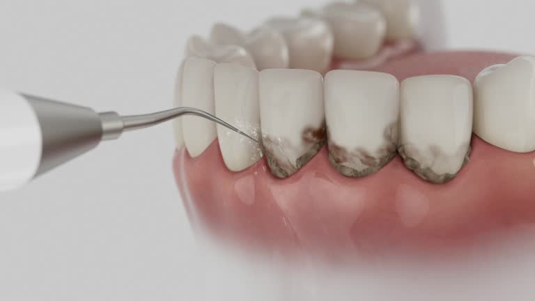 Reliable Tooth Extraction contractor in Somerset County County, MD by Dentist Open Now